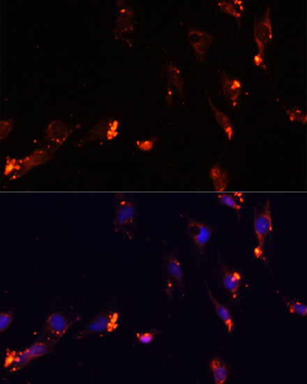 Immunofluorescence analysis of C6 cells using IKBKE Polyclonal Antibody at dilution of  1:100. Blue: DAPI for nuclear staining.