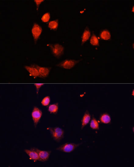 Immunofluorescence analysis of HeLa cells using IKBKE Polyclonal Antibody at dilution of  1:100. Blue: DAPI for nuclear staining.