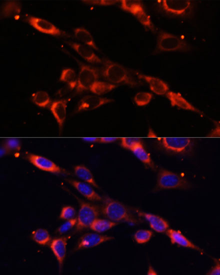 Immunofluorescence analysis of NIH/3T3 cells using IKBKE Polyclonal Antibody at dilution of  1:100. Blue: DAPI for nuclear staining.