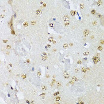 Immunohistochemistry of paraffin-embedded Mouse brain using IKBKE Polyclonal Antibody at dilution of  1:100 (40x lens).