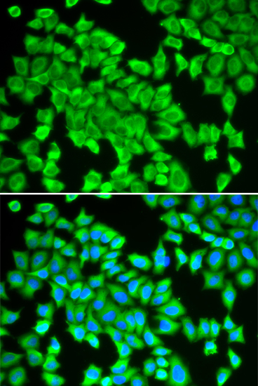 Immunofluorescence analysis of HeLa cells using STIP1 Polyclonal Antibody