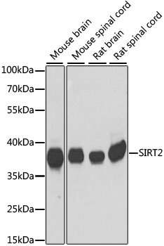 Western blot analysis of extracts of various cell lines using SIRT2 Polyclonal Antibody at dilution of 1:1000.