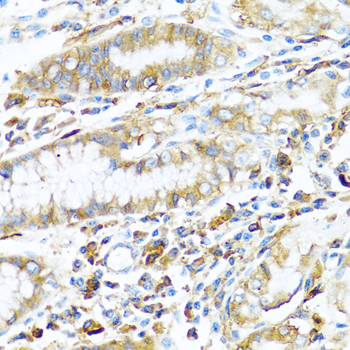 Immunohistochemistry of paraffin-embedded Human stomach using HLA-DPB1 Polyclonal Antibody at dilution of  1:100 (40x lens).