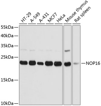 Western blot analysis of extracts of various cell lines using NOP16 Polyclonal Antibody at dilution of 1:3000.