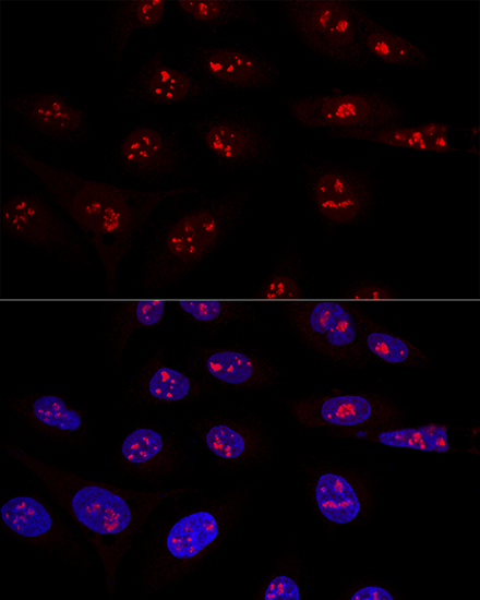 Confocal immunofluorescence analysis of U2OS cells using NOP58 Polyclonal Antibody at dilution of  1:100. Blue: DAPI for nuclear staining.