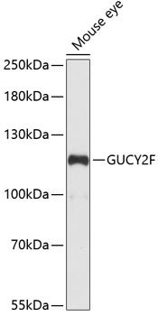 Western blot analysis of extracts of Mouse eye using GUCY2F Polyclonal Antibody at dilution of 1:1000.