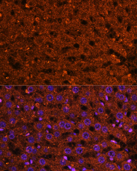 Immunofluorescence analysis of Rat liver using HMGCS2 Polyclonal Antibody at dilution of  1:100 (40x lens). Blue: DAPI for nuclear staining.