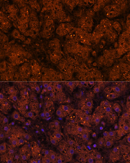 Immunofluorescence analysis of Human liver using HMGCS2 Polyclonal Antibody at dilution of  1:100 (40x lens). Blue: DAPI for nuclear staining.