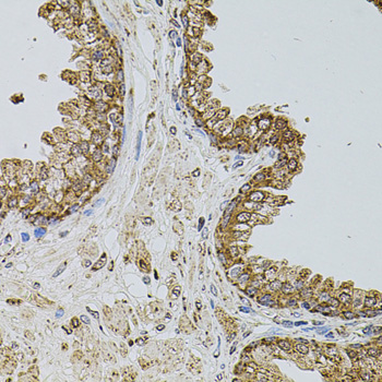 Immunohistochemistry of paraffin-embedded Human prostate using SELP Polyclonal Antibody at dilution of  1:100 (40x lens).