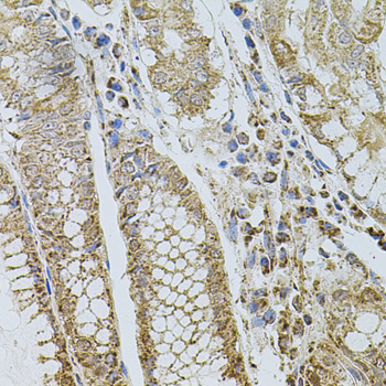 Immunohistochemistry of paraffin-embedded Human stomach using SELP Polyclonal Antibody at dilution of  1:100 (40x lens).