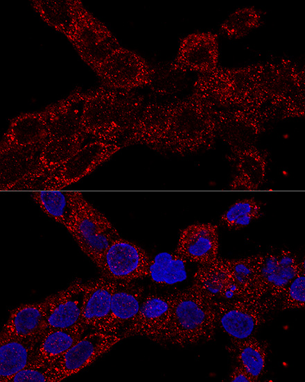 Confocal immunofluorescence analysis of A-431 cells using RPL21 Polyclonal Antibody at dilution of  1:100. Blue: DAPI for nuclear staining.