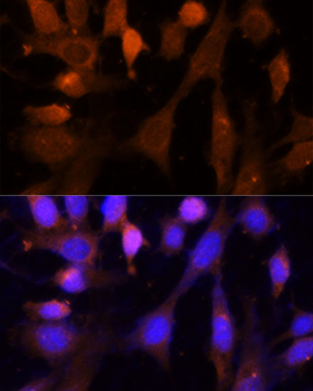 Immunofluorescence analysis of NIH-3T3 cells using VPS26A Polyclonal Antibody at dilution of  1:100 (40x lens). Blue: DAPI for nuclear staining.