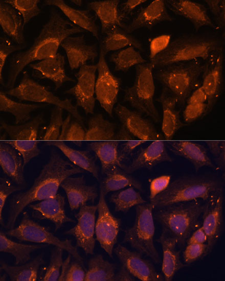 Immunofluorescence analysis of U-2 OS cells using NDUFA4L2 Polyclonal Antibody at dilution of  1:100. Blue: DAPI for nuclear staining.