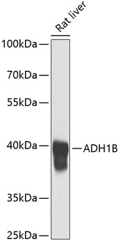 Western blot analysis of extracts of Rat liver using ADH1B Polyclonal Antibody at dilution of 1:1000.