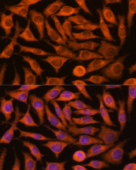 Immunofluorescence analysis of L929 cells using NDUFAF4 Polyclonal Antibody at dilution of  1:100. Blue: DAPI for nuclear staining.