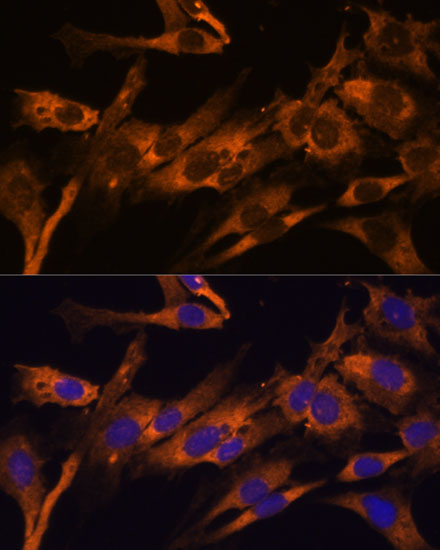 Immunofluorescence analysis of C6 cells using RPL36AL Polyclonal Antibody at dilution of  1:100 (40x lens). Blue: DAPI for nuclear staining.