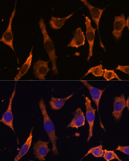 Immunofluorescence analysis of L929 cells using RPL36AL Polyclonal Antibody at dilution of  1:100 (40x lens). Blue: DAPI for nuclear staining.