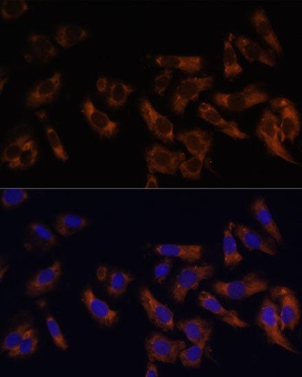 Immunofluorescence analysis of U-2 OS cells using RPL36AL Polyclonal Antibody at dilution of  1:100 (40x lens). Blue: DAPI for nuclear staining.