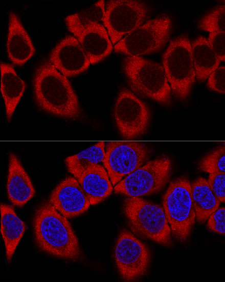 Confocal immunofluorescence analysis of HeLa cells using RPL36AL Polyclonal Antibody at dilution of  1:100. Blue: DAPI for nuclear staining.