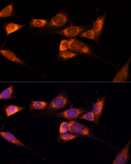 Immunofluorescence analysis of NIH-3T3 cells using TXNDC12 Polyclonal Antibody at dilution of  1:100 (40x lens). Blue: DAPI for nuclear staining.