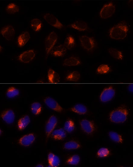 Immunofluorescence analysis of U-2 OS cells using TXNDC12 Polyclonal Antibody at dilution of  1:100 (40x lens). Blue: DAPI for nuclear staining.