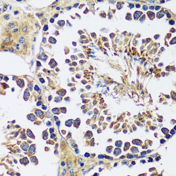 Immunohistochemistry of paraffin-embedded Mouse testis using CCDC124 Polyclonal Antibody at dilution of  1:100 (40x lens).