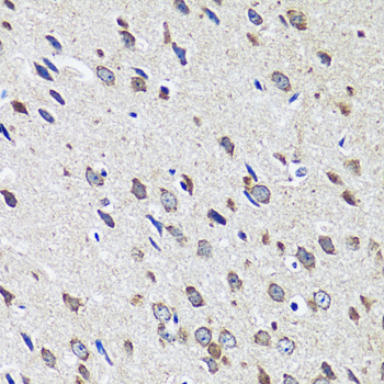 Immunohistochemistry of paraffin-embedded Mouse brain using CCDC124 Polyclonal Antibody at dilution of  1:100 (40x lens).