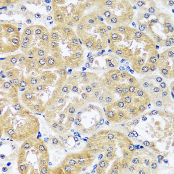 Immunohistochemistry of paraffin-embedded Mouse kidney using CCDC124 Polyclonal Antibody at dilution of  1:100 (40x lens).