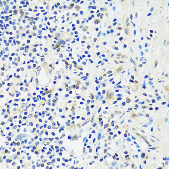 Immunohistochemistry of paraffin-embedded Human appendix using ASCL4 Polyclonal Antibody at dilution of  1:100 (40x lens).