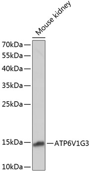 Western blot analysis of extracts of Mouse kidney using ATP6V1G3 Polyclonal Antibody at dilution of 1:1000.