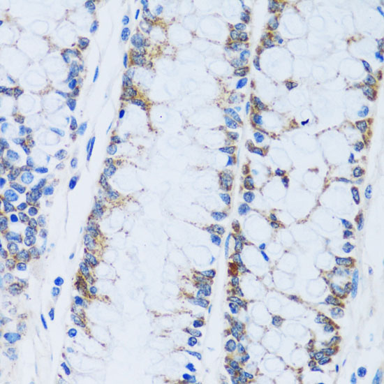 Immunohistochemistry of paraffin-embedded Human colon using CA13 Polyclonal Antibody at dilution of  1:100 (40x lens).