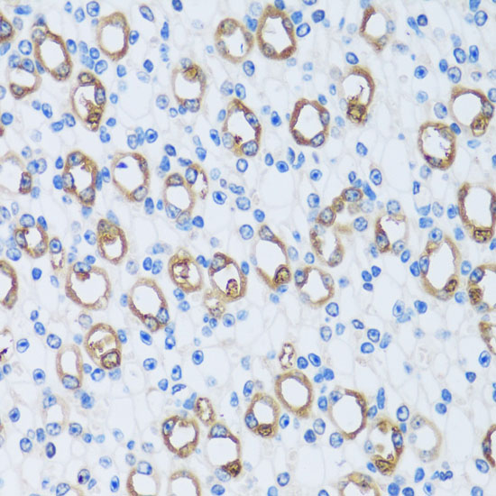 Immunohistochemistry of paraffin-embedded Mouse kidney using CA13 Polyclonal Antibody at dilution of  1:100 (40x lens).