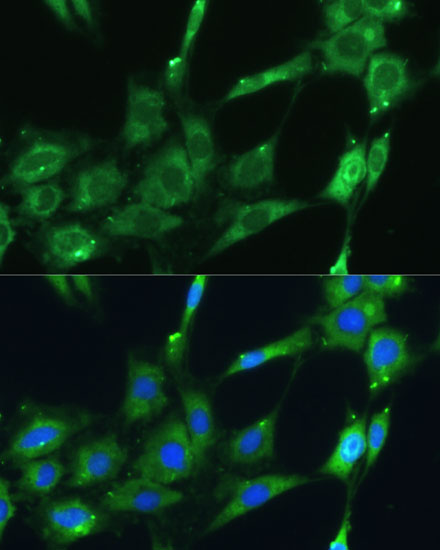 Immunofluorescence analysis of C6 cells using SPARC Polyclonal Antibody at dilution of  1:100 (40x lens). Blue: DAPI for nuclear staining.