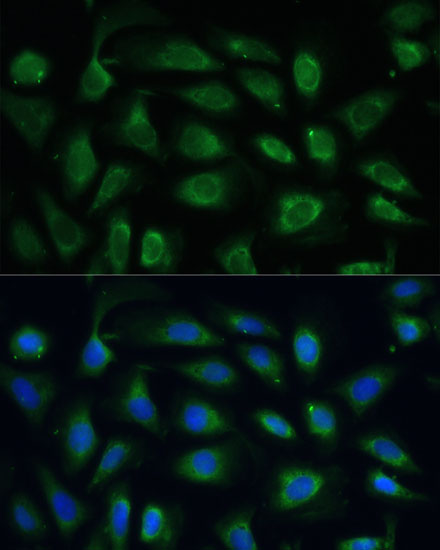 Immunofluorescence analysis of U-2 OS cells using SPARC Polyclonal Antibody at dilution of  1:100 (40x lens). Blue: DAPI for nuclear staining.