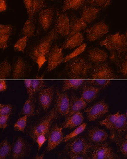 Immunofluorescence analysis of C6 cells using SMYD3 Polyclonal Antibody at dilution of  1:100. Blue: DAPI for nuclear staining.