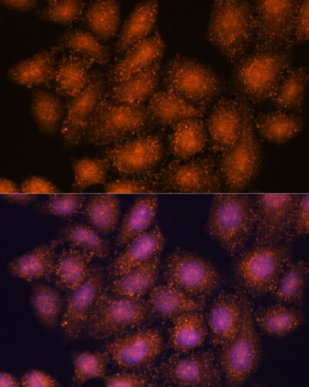 Immunofluorescence analysis of HeLa cells using SMYD3 Polyclonal Antibody at dilution of  1:100. Blue: DAPI for nuclear staining.