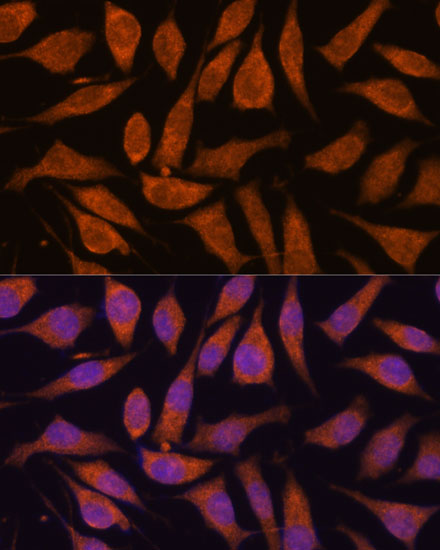 Immunofluorescence analysis of L929 cells using SMYD3 Polyclonal Antibody at dilution of  1:100. Blue: DAPI for nuclear staining.