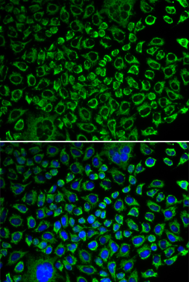Immunofluorescence analysis of A549 cells using F10 Polyclonal Antibody