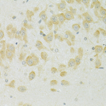 Immunohistochemistry of paraffin-embedded Rat brain using SLC37A4 Polyclonal Antibody at dilution of  1:100 (40x lens).