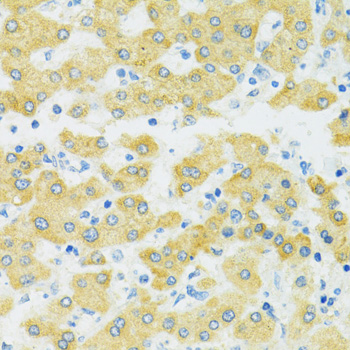 Immunohistochemistry of paraffin-embedded Human liver using SLC37A4 Polyclonal Antibody at dilution of  1:100 (40x lens).