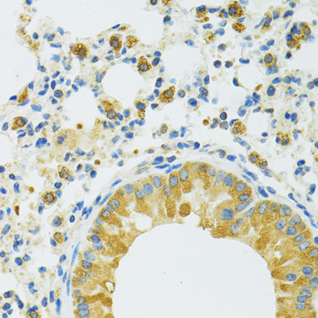 Immunohistochemistry of paraffin-embedded Mouse lung using SLC37A4 Polyclonal Antibody at dilution of  1:100 (40x lens).