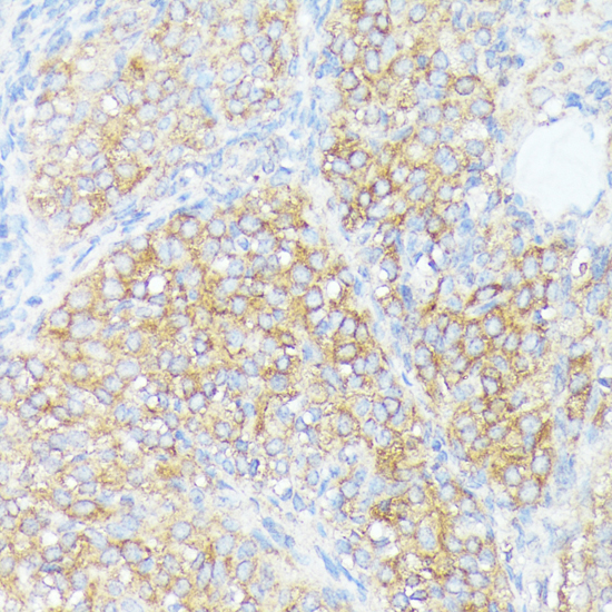 Immunohistochemistry of paraffin-embedded Rat ovary using SLC7A2 Polyclonal Antibody at dilution of  1:100 (40x lens).