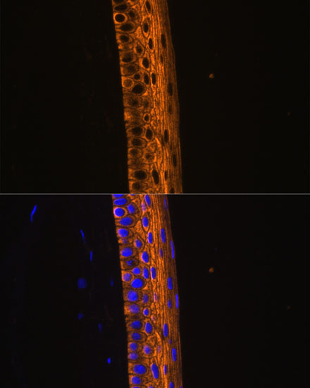 Immunofluorescence analysis of Rat eye using MYH13 Polyclonal Antibody at dilution of  1:100 (40x lens). Blue: DAPI for nuclear staining.