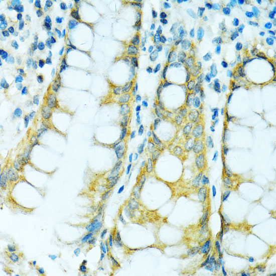 Immunohistochemistry of paraffin-embedded Human colon using CYP2B6 Polyclonal Antibody at dilution of  1:100 (40x lens).