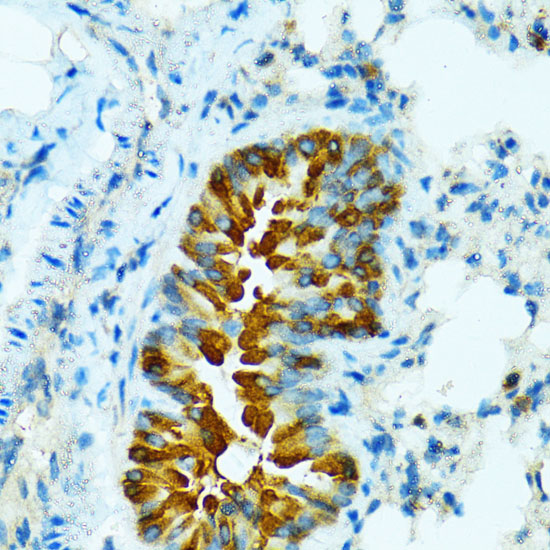 Immunohistochemistry of paraffin-embedded Mouse lung using CYP2B6 Polyclonal Antibody at dilution of  1:100 (40x lens).