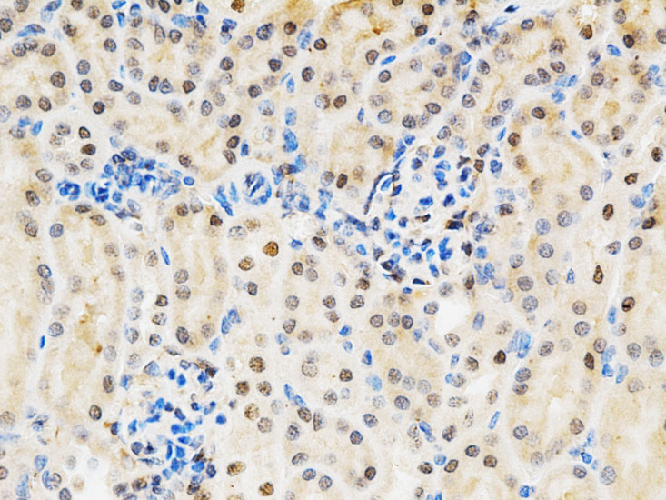 Immunohistochemistry of paraffin-embedded Mouse kidney using LGALS3 Polyclonal Antibody at dilution of  1:200 (40x lens).