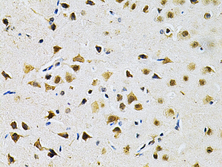 Immunohistochemistry of paraffin-embedded Rat brain using LGALS3 Polyclonal Antibody at dilution of  1:200 (40x lens).