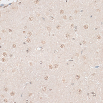 Immunohistochemistry of paraffin-embedded Mouse brain using HMGN1 Polyclonal Antibody at dilution of  1:100 (40x lens).