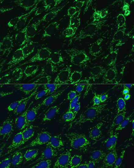 Immunofluorescence analysis of C6 cells using IDH3A Polyclonal Antibody at dilution of  1:100. Blue: DAPI for nuclear staining.