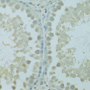 Immunohistochemistry of paraffin-embedded Rat testis using HUS1B Polyclonal Antibody at dilution of  1:100 (40x lens).